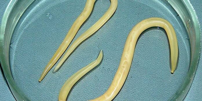 Human roundworms in a Petri dish - parasitize on the walls of the small intestine