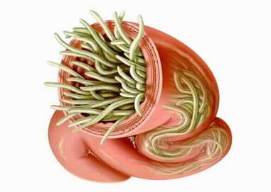 Types of parasites in the human body